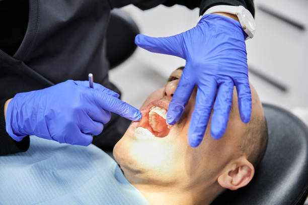 Best Emergency Dentist for Knocked-Out Tooth in Nocona, TX